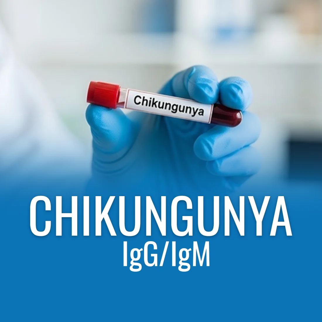 Chikungunya Fever IgG/IgM