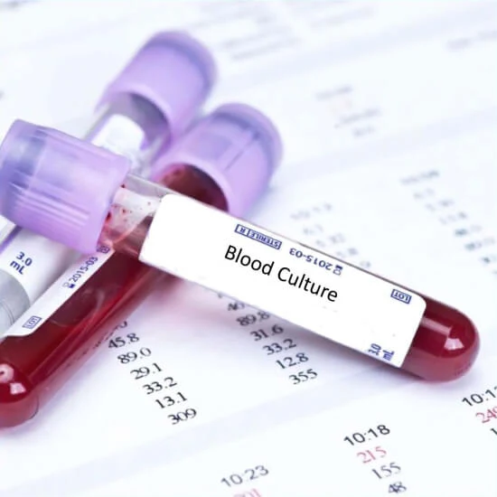 Culture & Sensivity (Blood)
