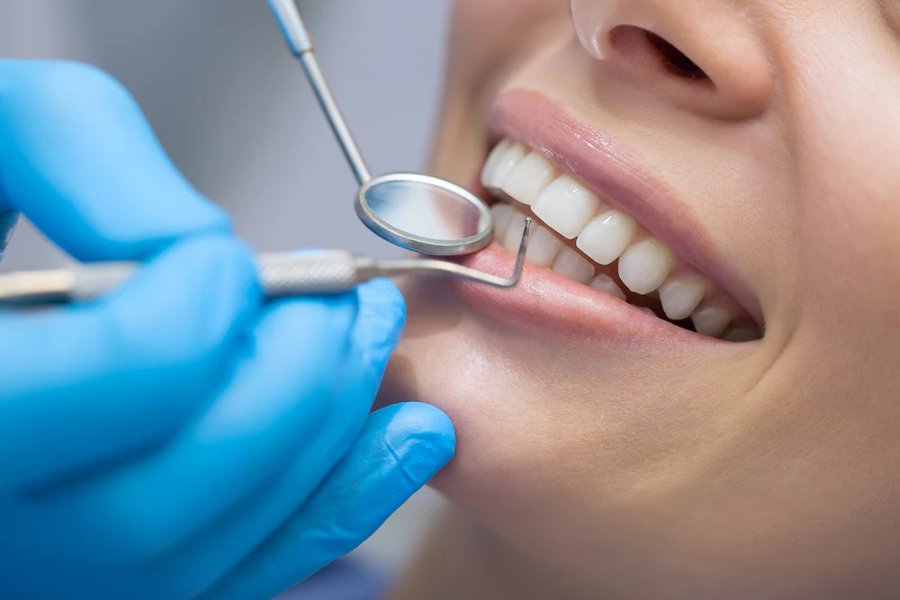 Dental - Free Checkup