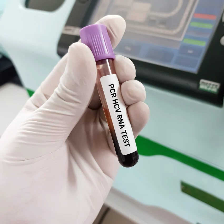 HCV RNA PCR (Quantitative)