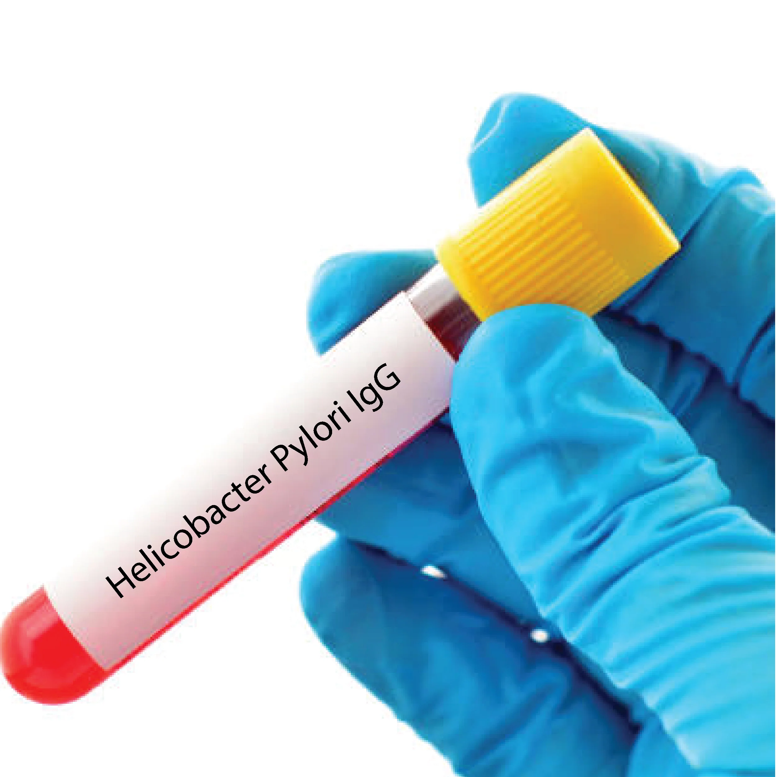 Helicobacter Pylori IgG