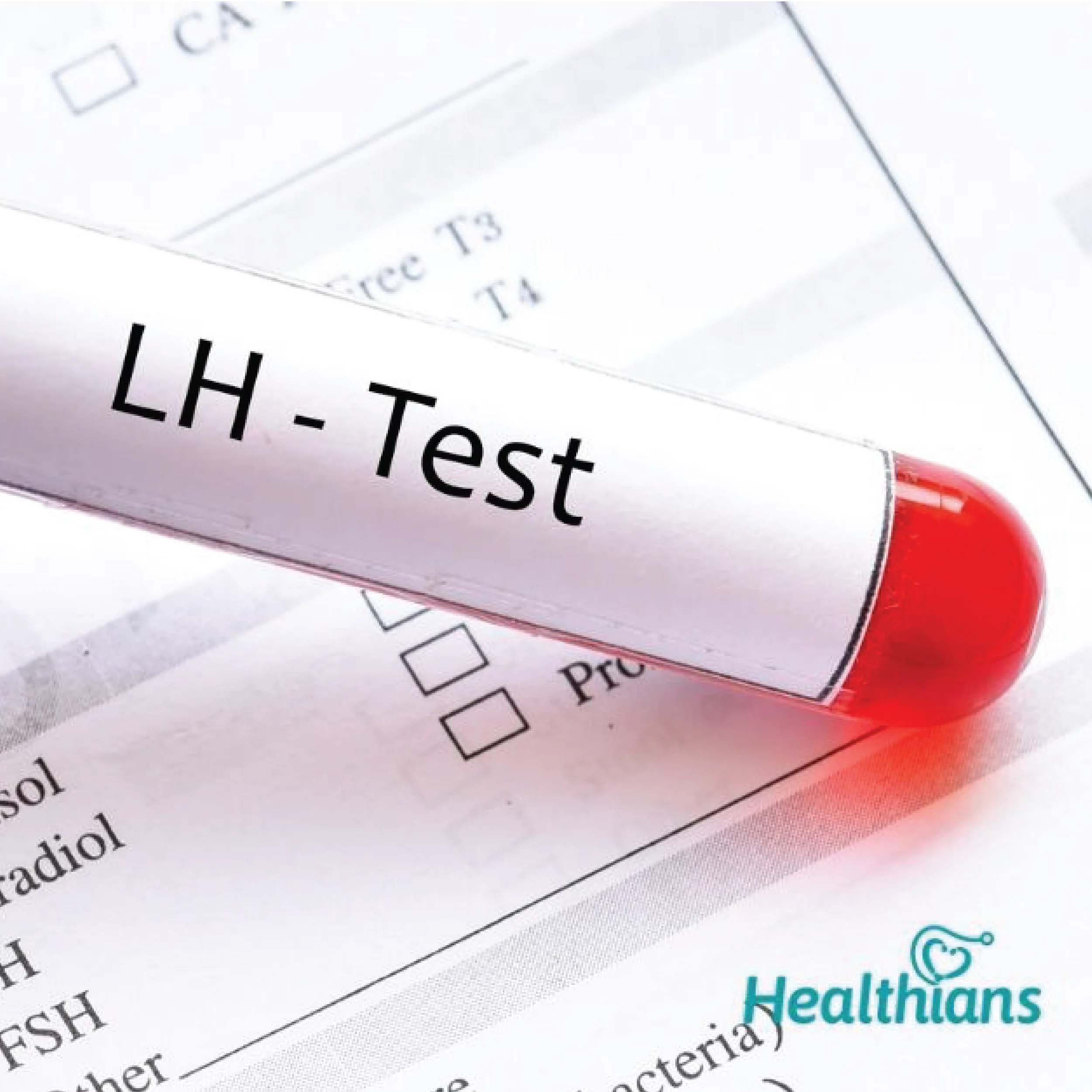 LH (Luteinizing hormone)