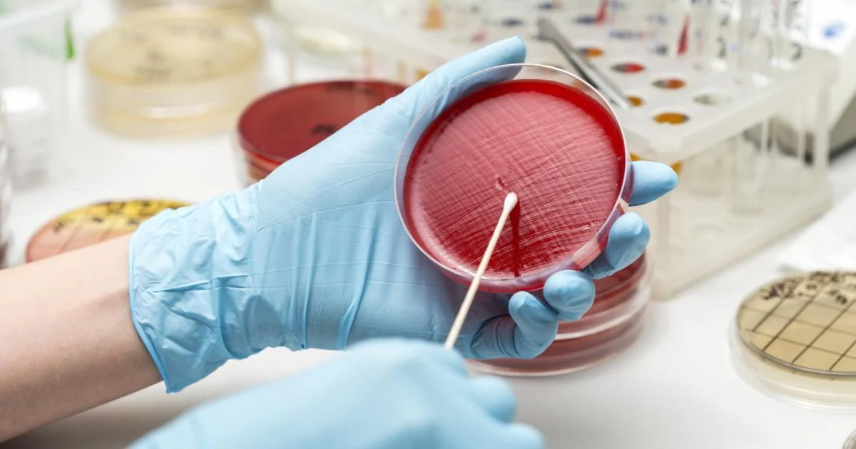 Culture & Sensivity (Throat Swab)