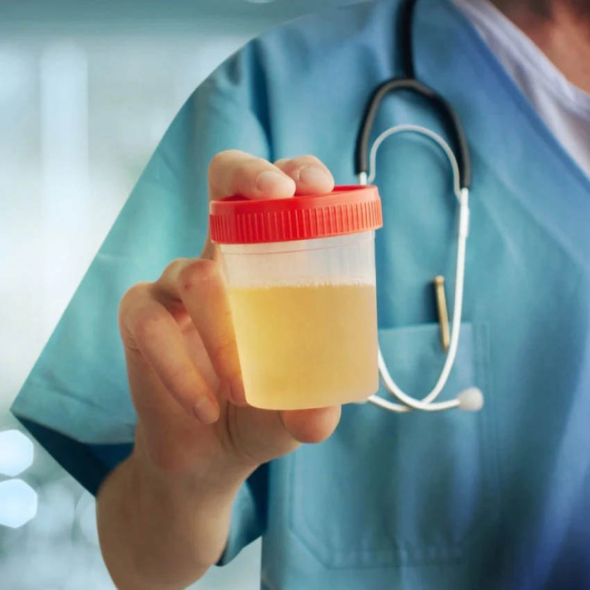Urine Albumin