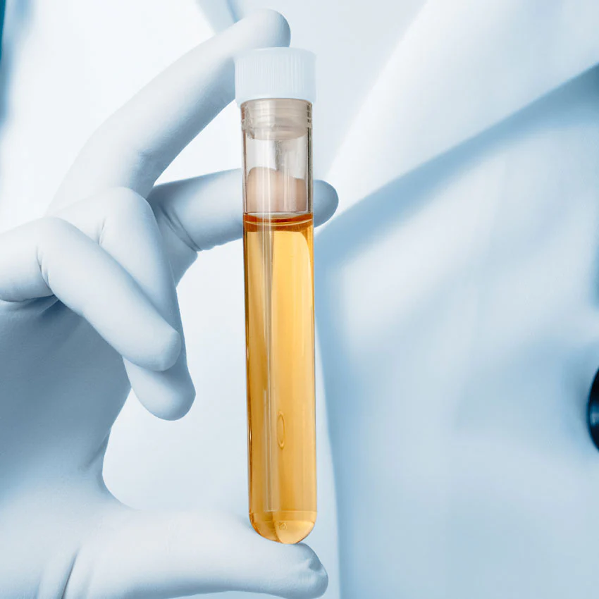 Urine for Cannabinoids