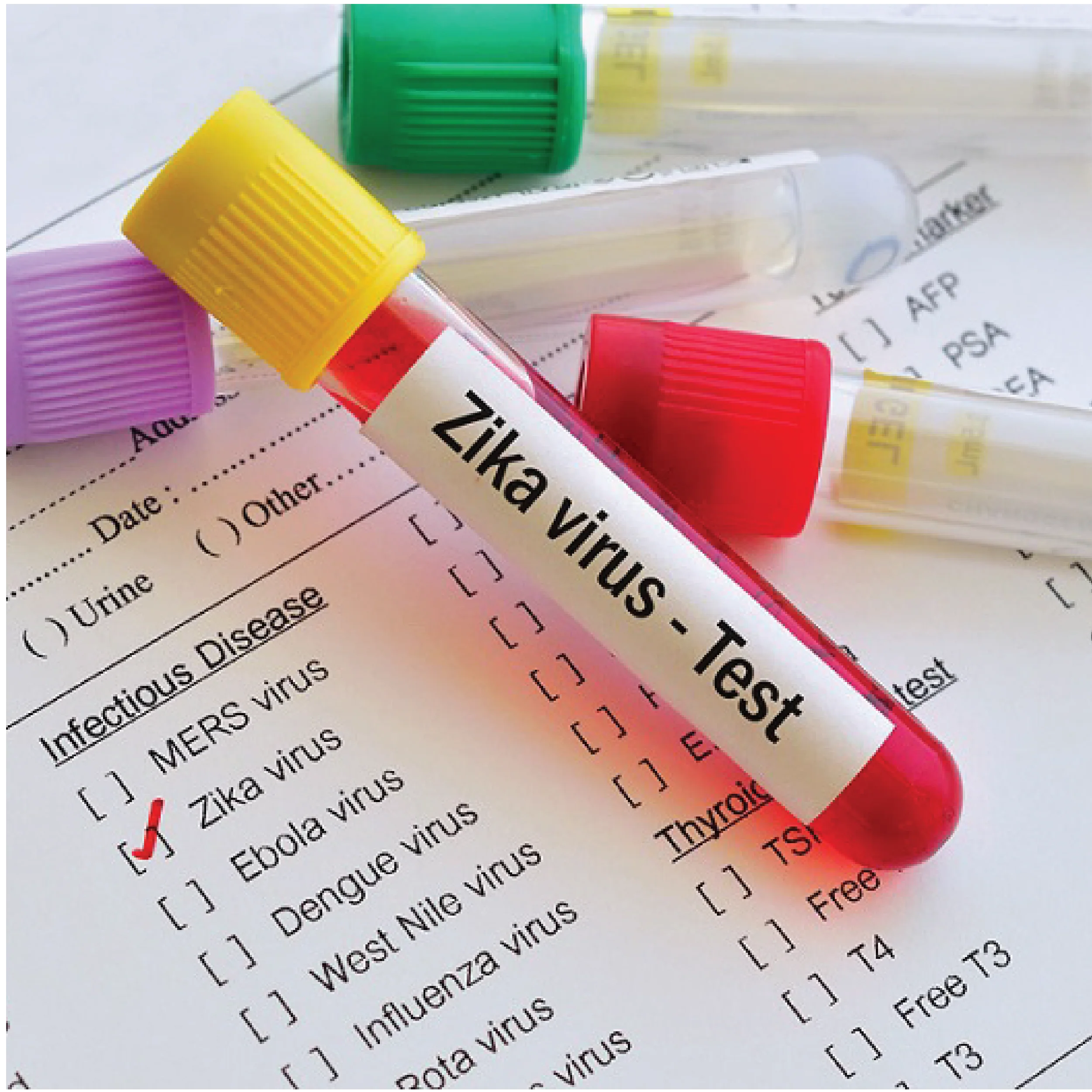 Zika Virus